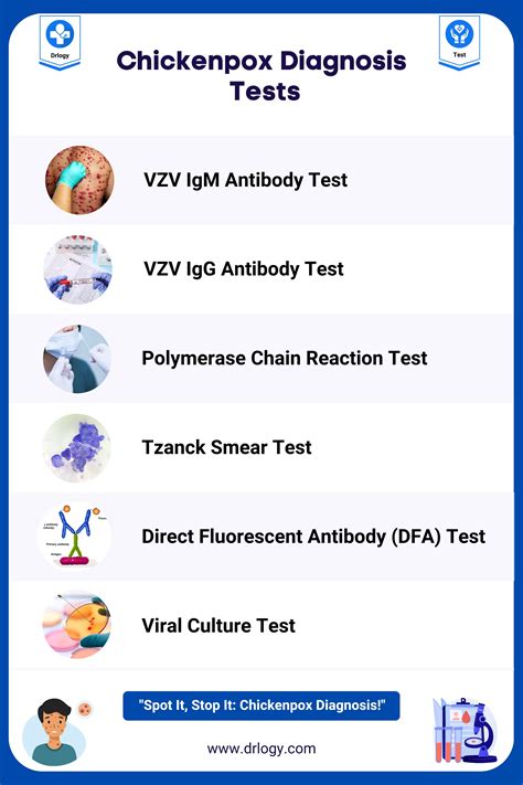 Varicella zoster (VZV) IgG antibodies (chicken, pox, shingles)